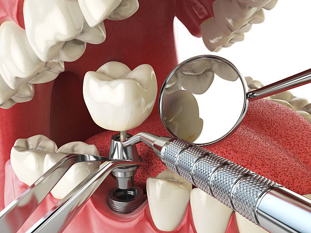 Best Walk-In Emergency Dentist in Alexandria, VA